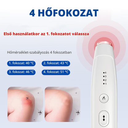 Elektromos csípéskezelő közelről